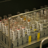 urine