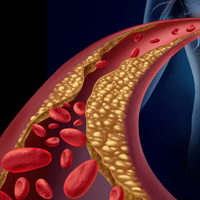 artery