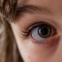 dilate