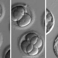 embryo