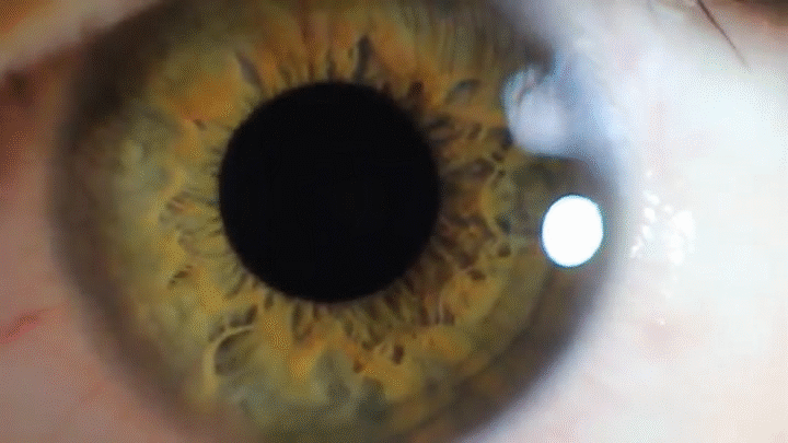 iris
