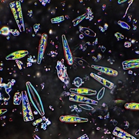diatoms