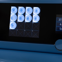 embryo screening