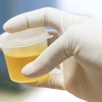 urine