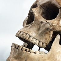 cranium