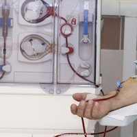 dialysis