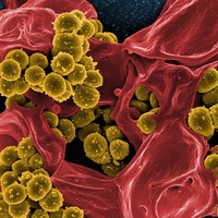 MRSA (Methicillin-resistant Staphylococcus aureus)