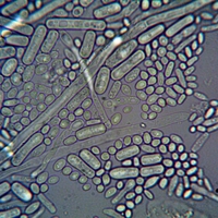 archaea