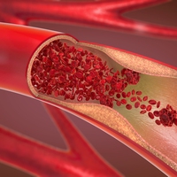 artery