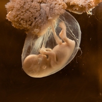 embryo