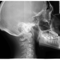 x-ray