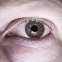 cornea
