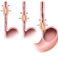 peristalsis