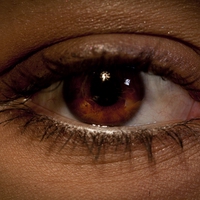 sclera