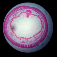 vacuole